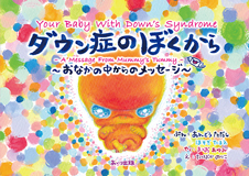 『ダウン症のぼくから』書影